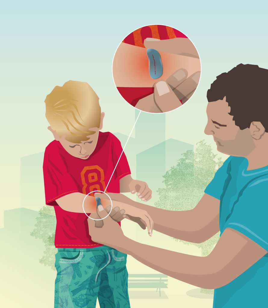 Een man smeert een blauwe gel op een schram van een verdrietige jongen. De close-up, gestileerd met duidelijk informatiedesign, toont een rode, geïrriteerde huid. De jongen draagt een rood shirt met een gele "8" en een blauwe spijkerbroek; vage bomen en gebouwen vullen de achtergrond.